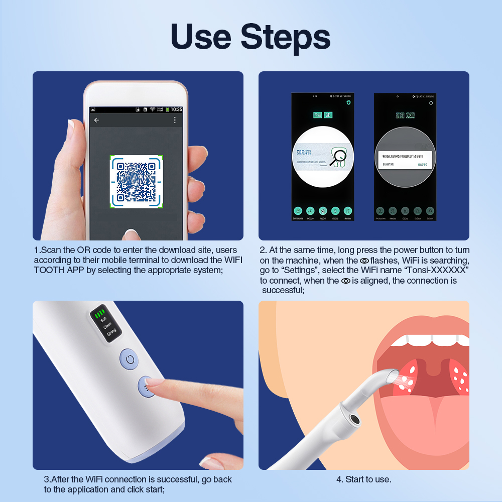 Smart Visual Tonsil Stone Remo - Lighting Visual 评论和价格