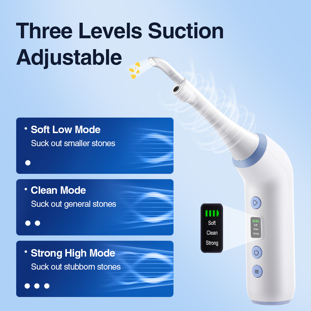Smart Visual Tonsil Stone Remo - Lighting Visual 评论和价格